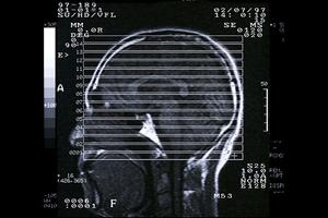 目黒区で選ばれるスポーツ整形クリニック2026年最新ガイド